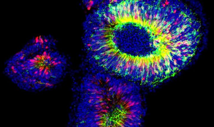 bacteria with artificial colours